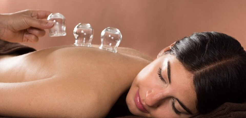Cupping Therapy Cupping Therapy