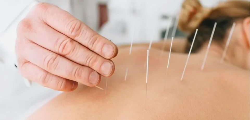 Dry Needling Therapy Dry Needling Therapy