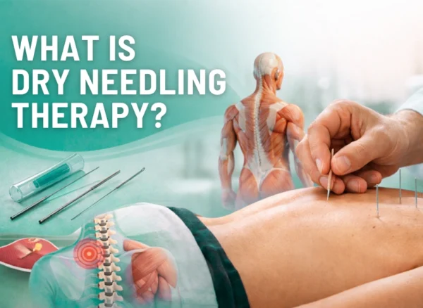 What is dry needling