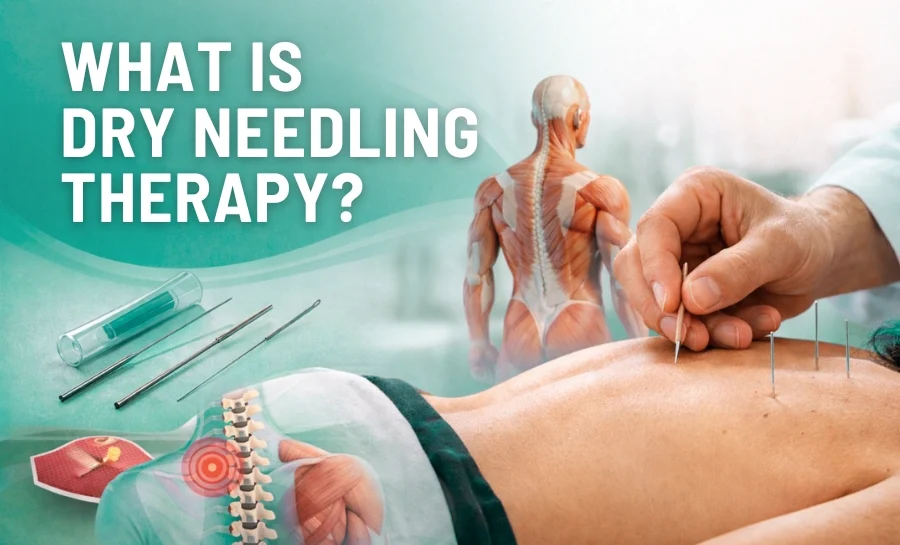 What is dry needling